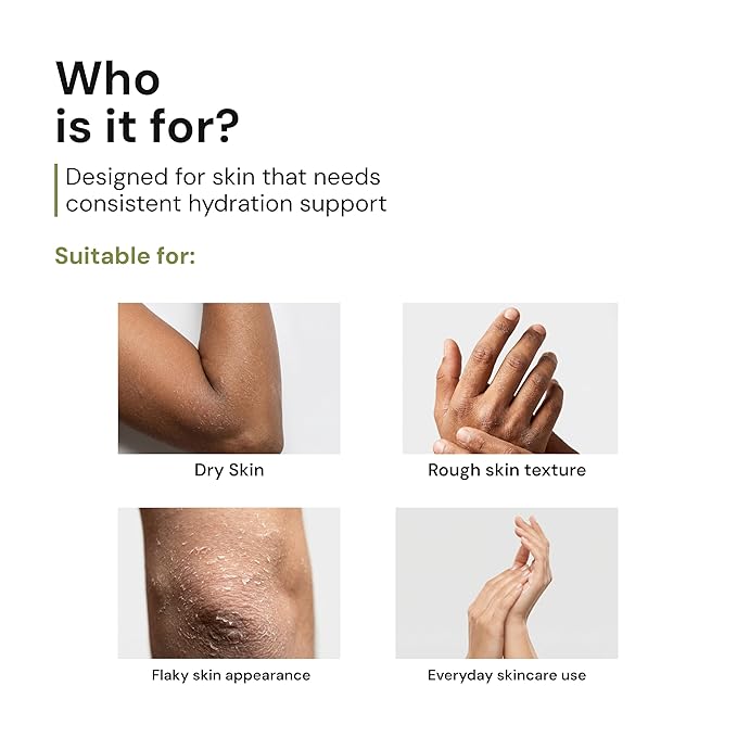 Parasoft Moisturizing Cream with Aloe Vera